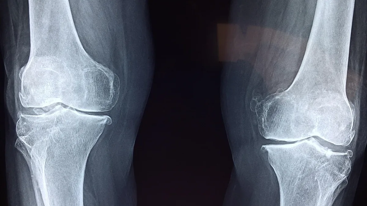 Arthritis